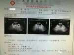 警方初步确认"12岁女孩产检"系被拐 陪同女子被拘 - Meizhou.Cn