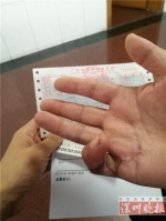 深圳男子花三万手指没治好 医院说：送你一次耳朵手术 - 新浪广东