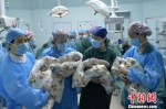 山西"80后"产妇生下罕见单卵四胞胎 属自然受孕 - Meizhou.Cn