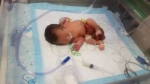 刚出生女婴大年初二被弃医院 消化器官露在肚子外 - Meizhou.Cn