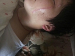 中学班会课起冲突：一学生被同学刀割双脸，老师不在场 - 广东电视网