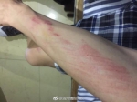 大学生情侣校园内搂抱被查遭围殴 涉事学生被处分 - 广东电视网