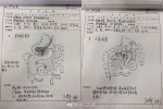 牛！63岁医生做8小时手术后不休息 画出详细手术图 - News.Timedg.Com