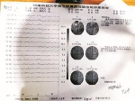 事后刘刚前往河南科技大学第五附属医院接受检查的诊断结果 - 新浪广东