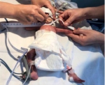 汕头超早产3胞胎“手掌宝宝”出院 出生不足两斤 - 新浪广东